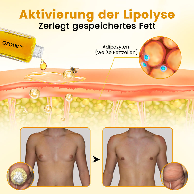 🐝GFOUK™ ThermoFirm Bienengift Öl zur Behandlung von Gynäkomastie
